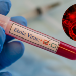 Comprehensive Study Notes on Ebola Virus Disease (EVD) for UPSC, SSC & State PCS Exams