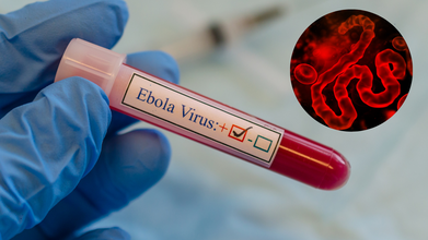 Comprehensive Study Notes on Ebola Virus Disease (EVD) for UPSC, SSC & State PCS Exams